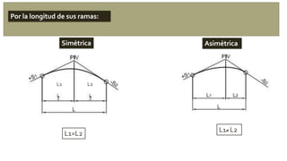 Simétrica Asimétrica
L1 L2
L1=L2
L1≠ L2
Por la longitud de sus ramas:
 