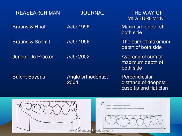 Curve of spee /certified fixed orthodontic courses by Indian dental academy