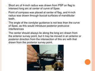o Short arc of 4-inch radius was drawn from PSP on flag to
intersect long arc at center of curve of Spee.
o Point of compass was placed at center of flag, and 4-inch
radius was drawn through buccal surfaces of mandibular
teeth.
o The angle of the condylar guidance is not less than the curve
of Spee, as this would introduce posterior protrusive
interferences
o The center should always lie along the long arc drawn from
the anterior survey point, but it may be moved in an anterior or
posterior direction from the intersection of this arc with that
drawn from the posterior survey point.
 
