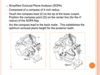  Simplified Occlusal Plane Analyser (SOPA)
o Composed of a compass of 4 inch radius.
o Touch the compass lead (C) to the tip of the lower cuspid.
Position the compass point (D) on the center line (for the 4”
radius) of the SOPA flag.
o Arc the compass lead to the back molar . This establishes the
optimum occlusal plane height for the posterior teeth.
 