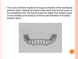  The curve of Wilson results from lingual inclination of the mandibular
posterior teeth, making the lingual cusps lower than buccal cusps on
the mandibular arch; the buccal cusps are higher than palatal cusps
on the maxillary arch because of the buccal inclination of maxillary
posterior teeth.
 