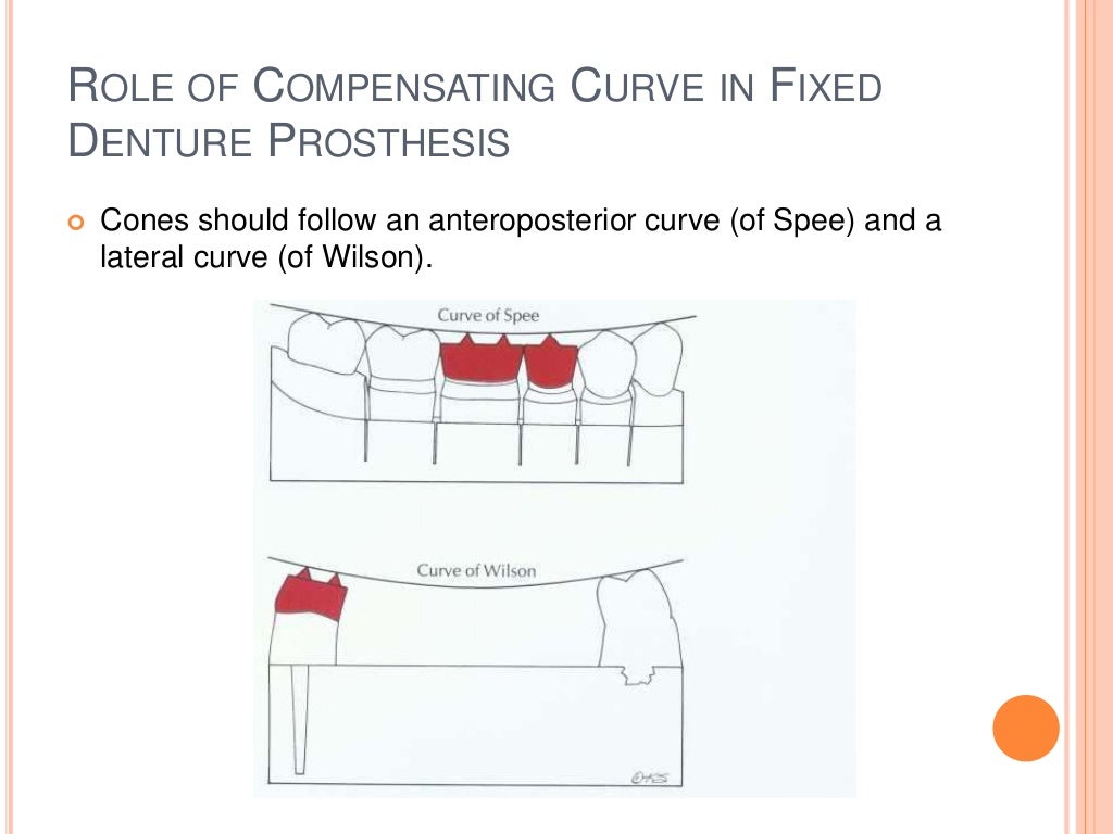 Compensating Curves in Prosthodontics