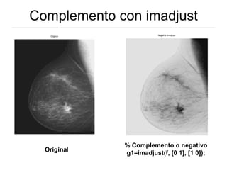 Imadjust Parameters Imagen e histograma | PPT