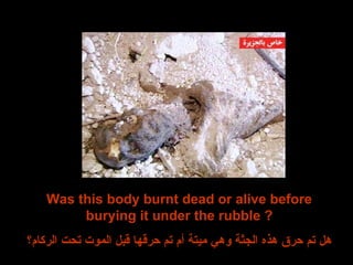 Was this body burnt dead or alive before burying it under the rubble ? هل تم حرق هذه الجثة وهي ميتة أم تم حرقها قبل الموت تحت الركام؟ 