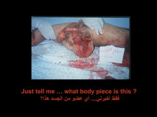 Just tell me … what body piece is this ?  فقط أخبرني ...  أي عضو من الجسد هذا؟ 