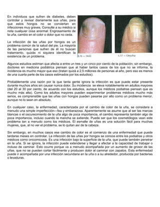 Curso pdf de manicure