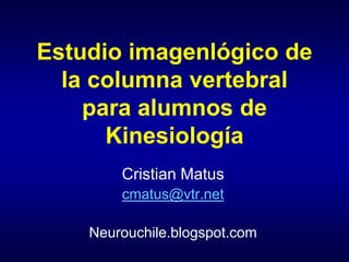 Estudio imagenlógico de
  la columna vertebral
    para alumnos de
      Kinesiología
        Cristian Matus
        cmatus@vtr.net

    Neurouchile.blogspot.com
 