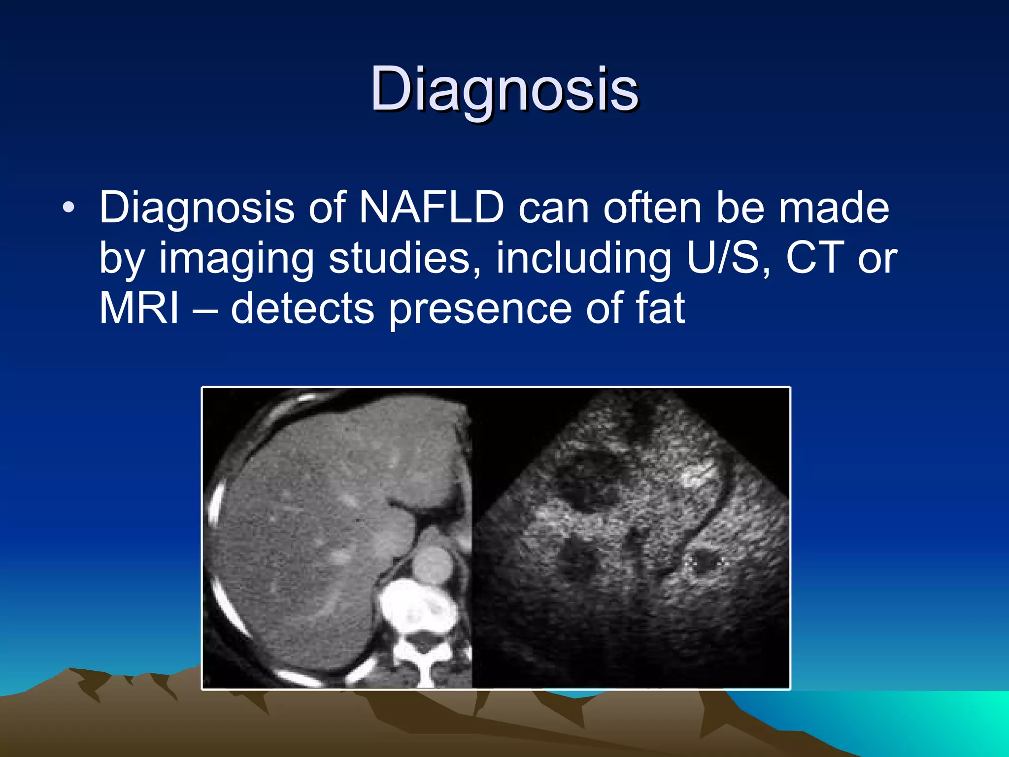 Diagnosis Diagnosis of NAFLD can often be made by imaging studies, including U/S, CT or MRI – detects presence of fat 