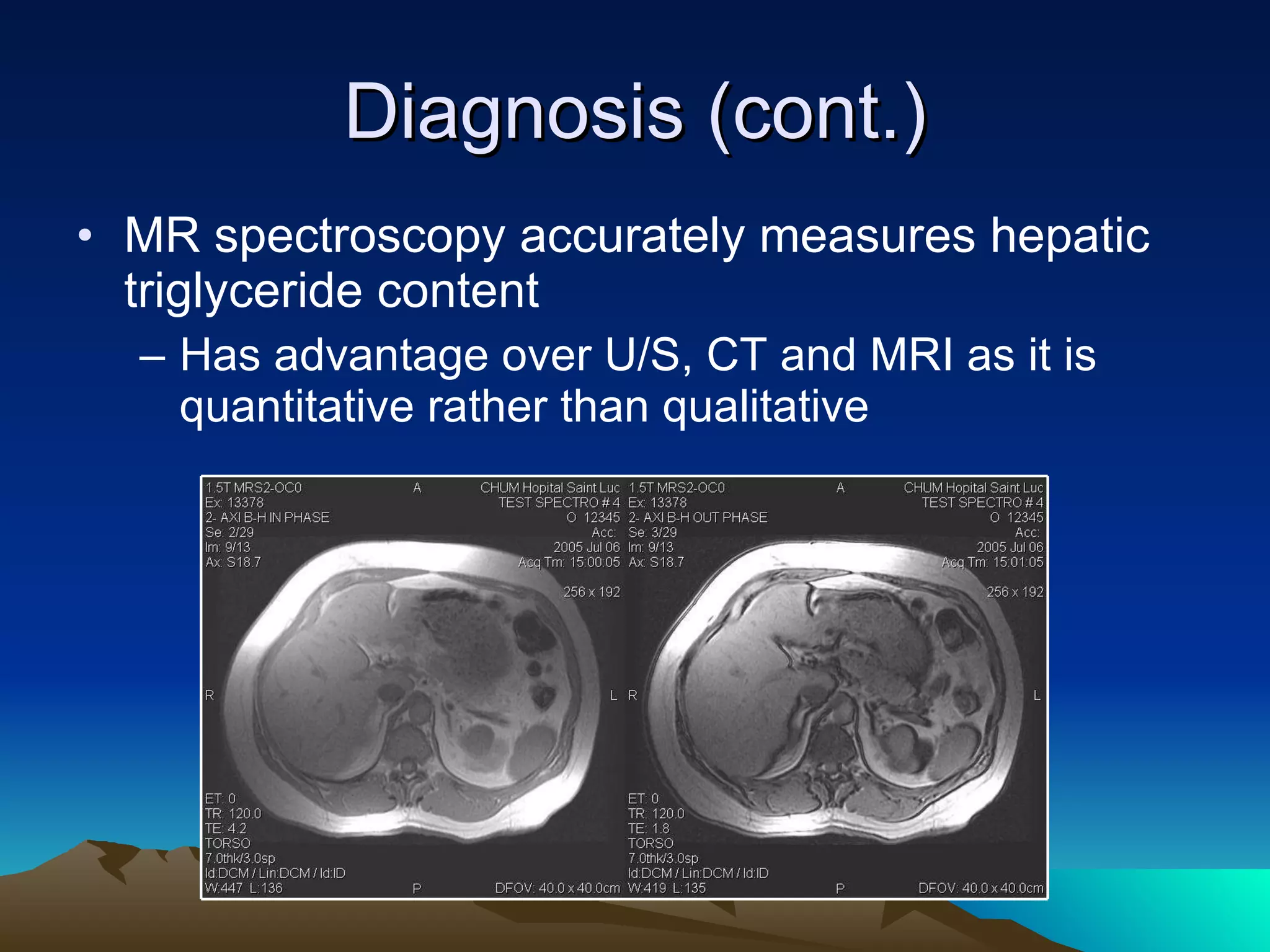 Diagnosis (cont.) MR spectroscopy accurately measures hepatic triglyceride content Has advantage over U/S, CT and MRI as it is quantitative rather than qualitative 