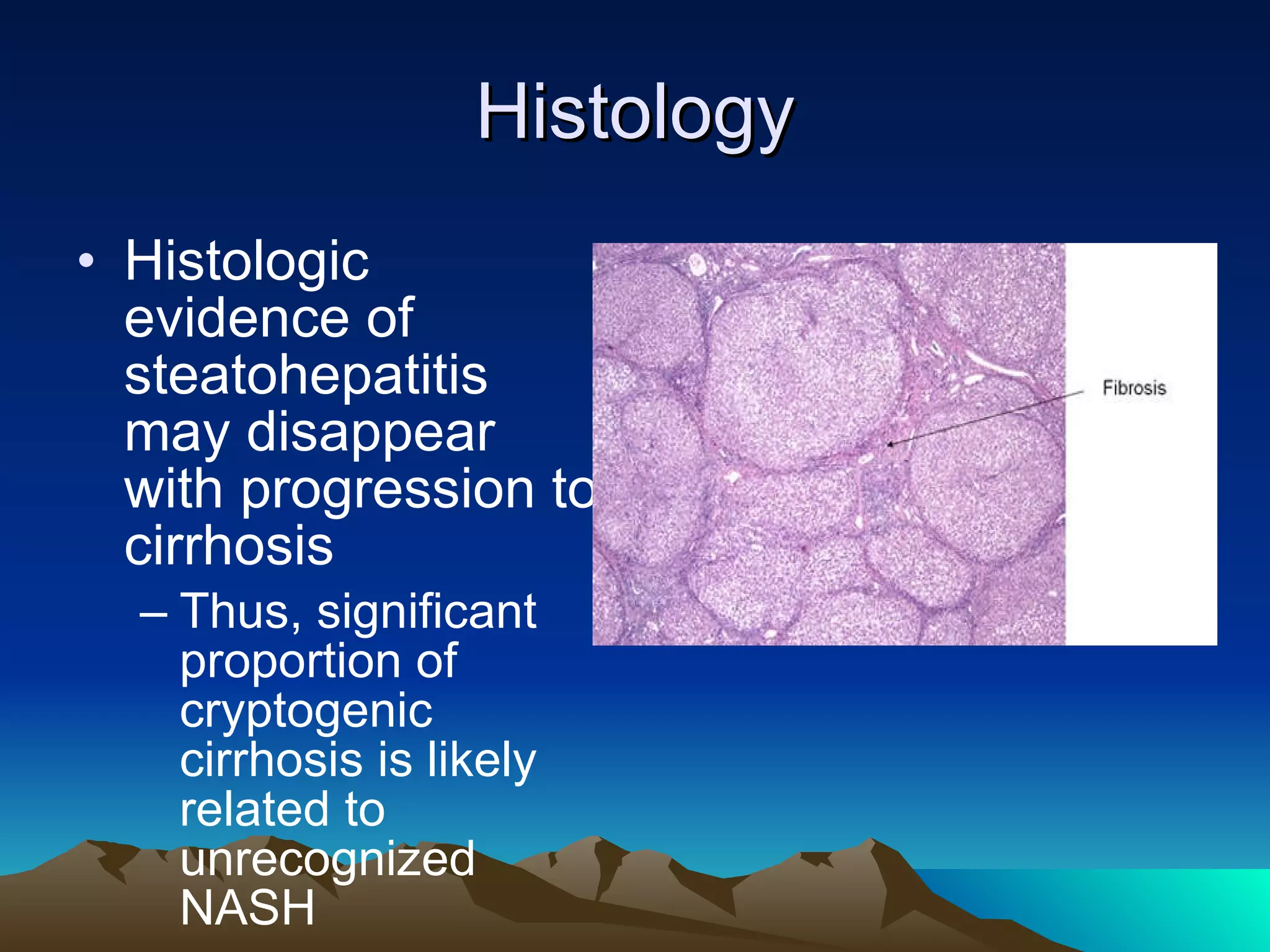 Histology Histologic evidence of steatohepatitis may disappear with progression to cirrhosis  Thus, significant proportion of cryptogenic cirrhosis is likely related to unrecognized NASH  