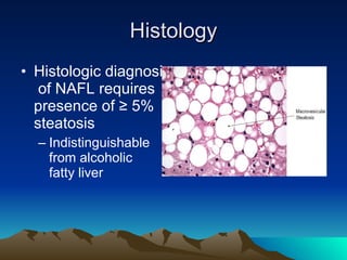 Histology Histologic diagnosis  of NAFL requires presence of ≥ 5% steatosis Indistinguishable  from alcoholic  fatty liver 