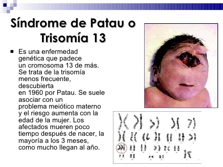 C\Users\Departamento B\Desktop\Mutaciones CromosóMicas
