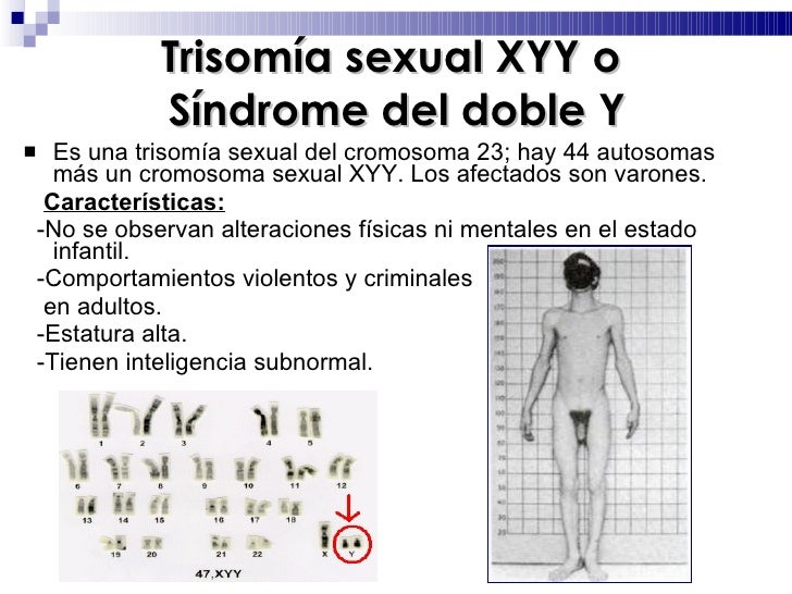 Resultado de imagen para Síndrome y XXX de XYY síndrome