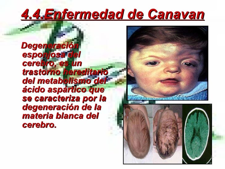 El complejo de la osteocondrosis de pecho