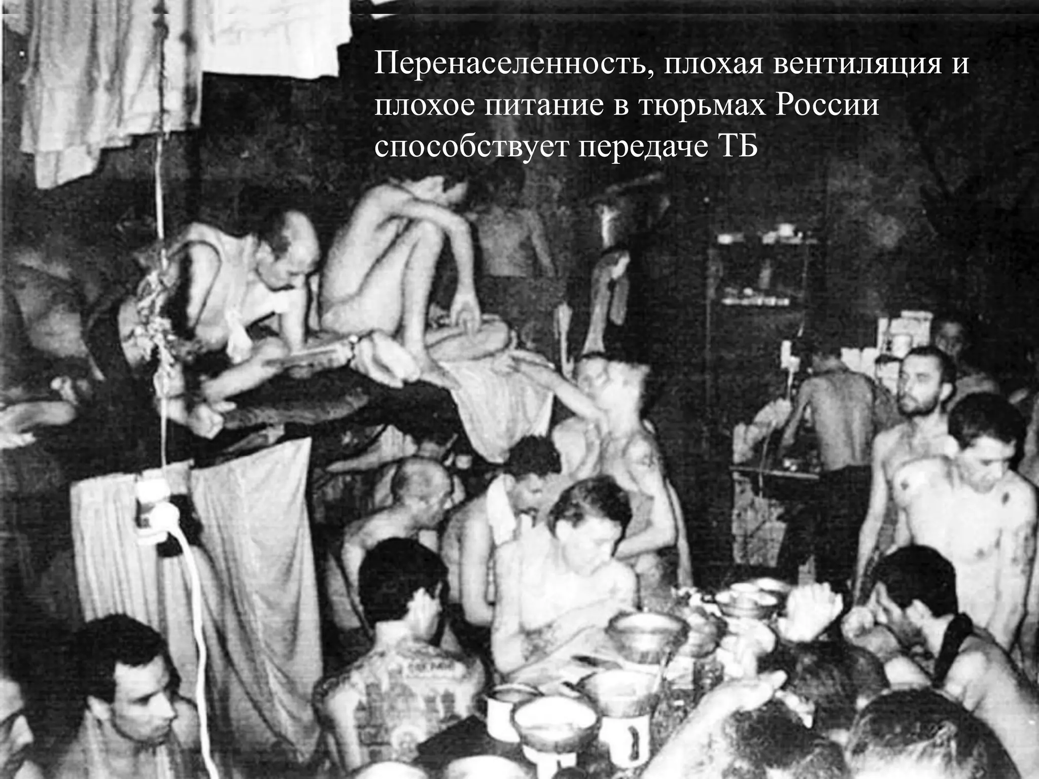 Перенаселенность, плохая вентиляция и
плохое питание в тюрьмах России
способствует передаче ТБ
 