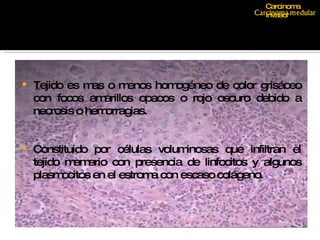 Tejido es mas o menos homogéneo de color grisáceo con focos amarillos opacos o rojo oscuro debido  a necrosis o hemorragias.  Constituido por células voluminosas que infiltran el tejido mamario con presencia de  linfocitos y algunos plasmocitos en el estroma con escaso colágeno.  Carcinoma invasor 