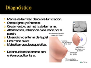 Menos de la mitad descubre tumoración. Otros signos y síntomas: Crecimiento o asimetría de la mama. Alteraciones, retracción o exudado por el pezón. Ulceración o eritema de la piel. Una masa axilar Molestia musculoesqueletica. Dolor suele relacionarse con  enfermedad benigna. 