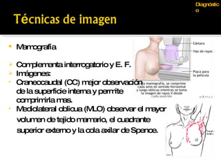 Mamografía Complementa interrogatorio y E. F. Imágenes: Craneocaudal (CC) mejor observación  de la superficie interna y permite  comprimirla mas. Mediolateral oblicua (MLO) observar el mayor volumen de tejido mamario, el cuadrante  superior externo y la cola axilar de Spence. Diagnóstico 