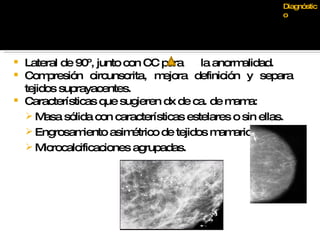 Lateral de 90º, junto con CC para  la anormalidad. Compresión circunscrita, mejora definición y separa tejidos suprayacentes. Características que sugieren dx de ca. de mama: Masa sólida con características estelares o sin ellas. Engrosamiento asimétrico de tejidos mamarios Microcalcificaciones agrupadas. Diagnóstico 