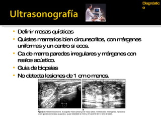 Definir masas quísticas Quistes mamarios bien circunscritos, con márgenes uniformes y un centro si ecos. Ca de mama paredes irregulares y márgenes con realce acústico. Guia de biopsias No detecta lesiones de 1 cm o menos. Diagnóstico 