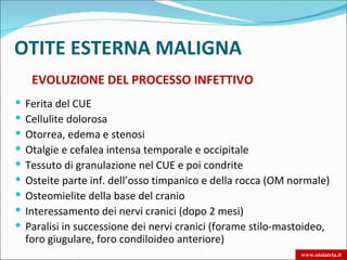 OTITE ESTERNA MALIGNA
     EVOLUZIONE DEL PROCESSO INFETTIVO
   Ferita del CUE
   Cellulite dolorosa
   Otorrea, edema e stenosi
   Otalgie e cefalea intensa temporale e occipitale
   Tessuto di granulazione nel CUE e poi condrite
   Osteite parte inf. dell’osso timpanico e della rocca (OM normale)
   Osteomielite della base del cranio
   Interessamento dei nervi cranici (dopo 2 mesi)
   Paralisi in successione dei nervi cranici (forame stilo-mastoideo,
    foro giugulare, foro condiloideo anteriore)
                                                               www.otoiatria.it
 