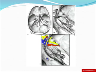 II         C

     III
                  V
           IV
           VI




                XI, X, IX




                            www.otoiatria.it
 
