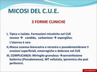 MICOSI DEL C.U.E.
                  3 FORME CLINICHE

I, Tipica e isolata. Formazioni micotiche nel CUE
    nevose  candida, carboniose  aspergillus.
    L’otorrea è rara
II, Massa caseosa biancastra o nerastra e pseudomembrane 
    erosioni superficiali, emorragiche e dolorose nel CUE
III, COMPLICANZA: Miringite granulosa sovrainfezione
    batterica (Pseudomonas). MT vellutata, iperemica che può
    perforarsi.

                                                        www.otoiatria.it
 