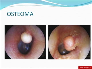 www.otoiatria.it
 