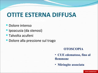 OTITE ESTERNA DIFFUSA
        SEGNI E SINTOMI
 Dolore intenso
 Ipoacusia (da stenosi)
 Talvolta acufeni
 Dolore alla pressione sul trago

                                      OTOSCOPIA
                                • CUE edematoso, fino al
                                flemmone
                                • Miringite associata

                                                        www.otoiatria.it
 