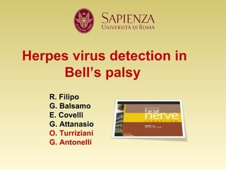 Herpes virus detection in Bell’s palsy  R. Filipo  G. Balsamo  E. Covelli  G. Attanasio  O. Turriziani G. Antonelli   