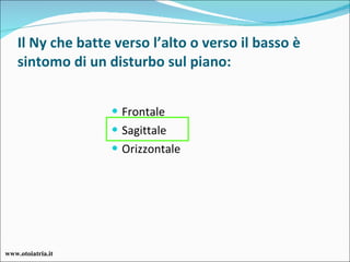 Il Ny che batte verso l’alto o verso il basso è sintomo di un disturbo sul piano: Frontale Sagittale Orizzontale www.otoiatria.it 