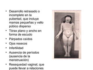 Desarrollo retrasado o incompleto en la pubertad, que incluye mamas pequeñas y vello púbico disperso  Tórax plano y ancho en forma de escudo  Párpados caídos  Ojos resecos  Infertilidad  Ausencia de períodos (ausencia de la menstruación)  Resequedad vaginal, que puede llevar a relaciones sexuales dolorosas  