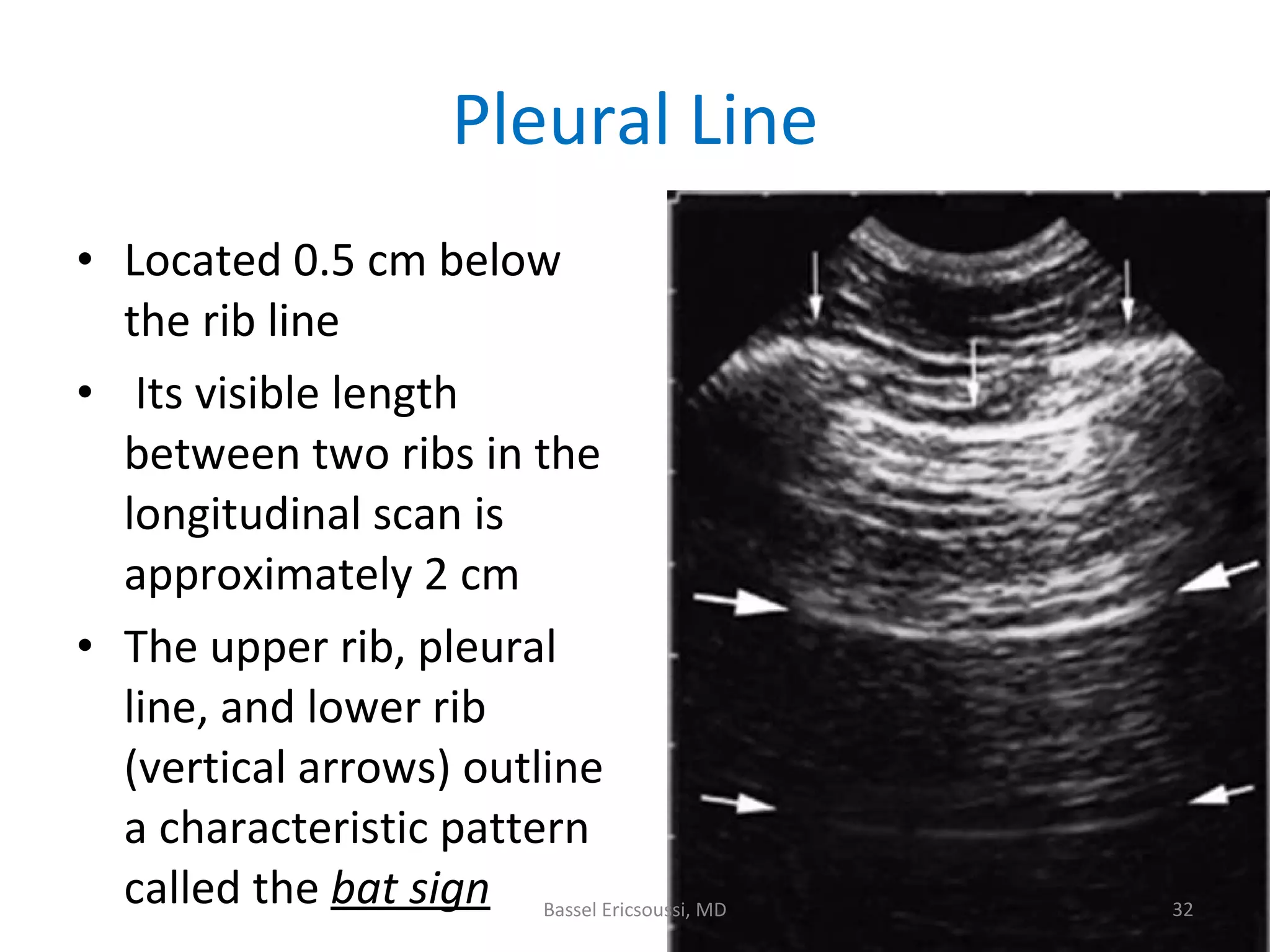 Ultrasonography Fundamentals In Critical Care: Lung Ultrasound, Pleural ...