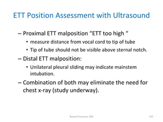 ETT Position Assessment with Ultrasound <ul><ul><li>Proximal   ETT malposition “ETT too high “ </li></ul></ul><ul><ul><ul>...