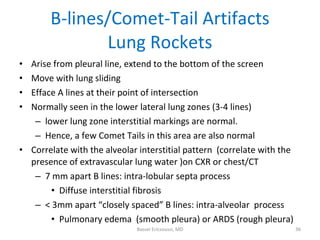 B-lines/Comet-Tail Artifacts Lung Rockets <ul><li>Arise from pleural line, extend to the bottom of the screen </li></ul><u...