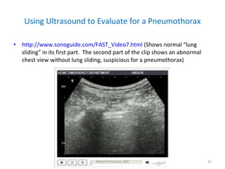 Using Ultrasound to Evaluate for a Pneumothorax <ul><li>http://www.sonoguide.com/FAST_Video7.html  (Shows normal “lung sli...