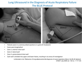 <ul><li>Patients were in a semirecumbent position or supine (if intubated ) </li></ul><ul><li>Scans were longitudinal </li...