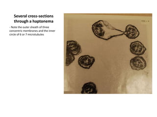 Sieve elements of NereocystisSieve elements are elongated cells  located with in the medulla 