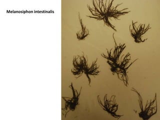 Often multinucleateCOLOURPink, Red, Purple, Black, Bluegreen, BrownishFLAGELLATIONNoneMORPHOLOGYSimple microscopic unicells-	Branched filaments-	Corticated filamentsCorticating cells surround in clusters the main filament-	pseudofilaments-	PolysiphonousfilamentsPolysiphonous cells arrange themselves like flower petals around the main axial cell by pitplugs-	Parenchymatousthalli-	Large complex pseudoparenchymatousthalliUniaxialpseudoparenchyma: 1 main filament with many coming off the sidesMultiaxialpseudoparenchyma: many main filaments together with many coming off the sidesREPRODUCTION-	Cell division:Unicells undergo simple cell divisionFilaments undergo cell division and elongation which can be apical and/or intercalarly-	Sexual Reproduction:Oogamous by fusion of spermatia  (non motile male sex cell) with a carpogonium (female reproductive organ)CHLOROPLASTS-	Chlorophyll a-	Unstackedthylakoids-	2 membranes around the chloroplast-	Starch is the storage product-	Stellateor discoid chloroplast shapes-	Phycobilisomespresent-	Pyrenoids(centers of carbon dioxide fixation within the chloroplasts) store RUBISCOChloroplast DNA Is scattered in nucleoidsEYESPOTSNoneCharacteristics Part 2LIFE HISTORYSporic meiosis with an alternation of isomorphic or heteromorphic generationsRed algae:Male gametophytes (n) produce spermatia (non motile male sex cells)Female gametophytes produce carpogonia (egg cells) that are retained on the female gametophyte plantAfter fertilization the zygote (2n) stays on the female gametophyte and develops into a carposporophyte (2n)This carposporophyte produces carpospores (2n) that are released and become tetrasporophytesEach tetrasporophyte produces tetrasporangia where meiotic divisions result in tetraspores (n) Polysiphonia: IsomorphicTetrasporophyte (2n)(small plant) is forming tetrasporangia (round balls)These tetrasporangia divide into four parts  four spores (n) are then formedFrom these spores, male and female gametophytes formTetrasporophytes and gametophytes look identicalThe spermatangia (male reproductive organs) are formed at the top of the branches of the gametophyte (look like small cucumbers) are crowded with spermatia (non motile male sex cells)Spermatia can melt together with the carpogonium (female reproductive organ also know as the oogonium)Nucleus of the male cell moves through the tube of the trichogyne (hair like receptive protuberance of the carpogonium) to the egg cell and a zygote is formed that develops into a cystocarp (fruiting structure with a special protective envelope produced after fertilization)In the cystocarp, carpospores are formed (2n) which escape through a hole and the top and can grow into a tetrosporophyte Porphyra: HeteromorphicConspicuous blades are gametophytes (n) that bear either spermatia or carpogonia or bothFertilization occurs in the situ on the female gametophyteThe zygote remains in the female gametophyte blade and divides to form many carpospores (2n)The carpospores are released and germinate to produce the “Conchocelis” stage (2n)This stage burrows into shells (i.e. oysters and clams) and produces spores called conchosporesConchospores form new thallus Mastocarpus: HeteromorphicFemale gametophyte (n) produce carpogonium (trichogyne + egg)Male gametophyte produce spermatia (n)Spermatia and carpogonia fuse to form carposporophyte (2n)Carposporophyte forms carpospores (2n)Carpospores are released and form tetrasporophyte (2n) Tetrasporophyte form tetrasporangia and meitotically divide to form tetraspores (n) which then go back to forming the male and female gametophytes