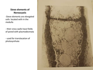MazzaellasplendensIf there are cystocarps (N)  present  containing carpospores (2N) then it is a gametophyte (N)