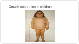Growth retardation in children
 