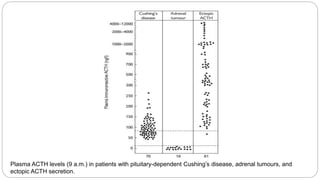 Plasma ACTH levels (9 a.m.) in patients with pituitary-dependent Cushing’s disease, adrenal tumours, and
ectopic ACTH secretion.
 