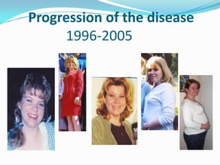 Progression of the disease
     1996-2005
 