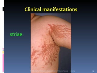 Clinical manifestations



striae




           PNT Students - Gertrude's Gardens Children's Hospital (2009)   05/07/09   23
 