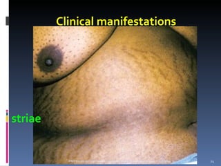 Clinical manifestations




striae


           PNT Students - Gertrude's Gardens Children's Hospital (2009)   05/07/09   24
 