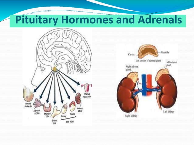 cushings syndrome.pptx