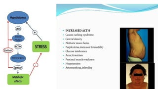 Comprehensive Overview of Cushing Syndrome and Pathological ...