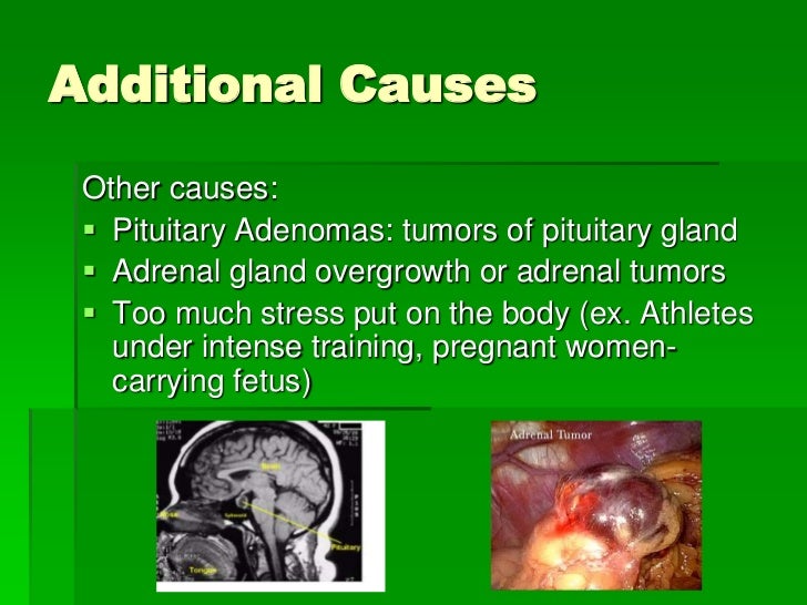 Cushing's syndrome final presentation!;).
