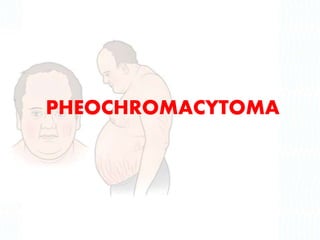PHEOCHROMACYTOMA
 