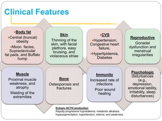 Clinical Features
Body fat
Central (truncal)
obesity
Moon facies,
Supraclavicular
fat pads, and Buffalo
hump
Skin
Thinning of the
skin, with facial
plethora, easy
bruising, and
violaceous striae
Muscle
Proximal muscle
weakness, and
atrophy
Wasting of the
extremities
Bone
Osteoporosis and
fractures
CVS
Hypertension,
Congestive heart
failure,
Hyperlipidemia,
Diabetes
Reproductive
Gonadal
dysfunction and
menstrual
irregularities
Immunity
Increased rate of
infections
Poor wound
healing
Psychologic
disturbances
(e.g.,
depression,
emotional lability,
irritability, sleep
disturbances)
Ectopic ACTH production
Rapidly progressive hypokalemia, metabolic alkalosis,
hyperpigmentation, hypertension, edema, and weakness
 